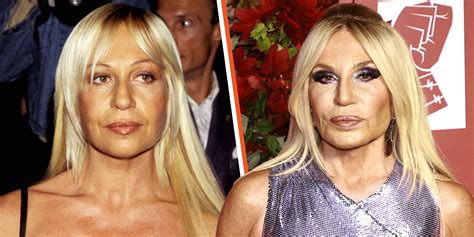 donatella versace før og efter|Donatella Versace age.